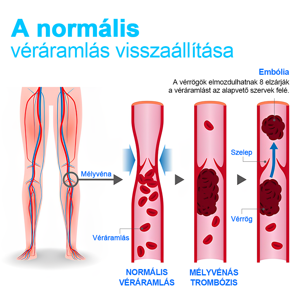 💎PEARLMOON™ Ionos Korrekció Limfás Detoxikáció Hosszú Cső Selyem Harisnya(⭐⭐⭐Korlátozott ideig érvényes kedvezmény, utolsó 30 perc)