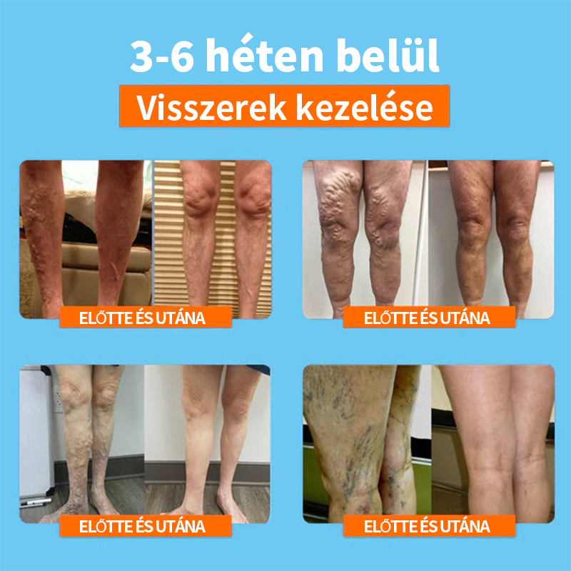 💎PEARLMOON™ Ionos Korrekció Limfás Detoxikáció Hosszú Cső Selyem Harisnya(⭐⭐⭐Korlátozott ideig érvényes kedvezmény, utolsó 30 perc)